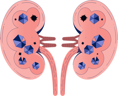 Illustration Oxalate dans les reins